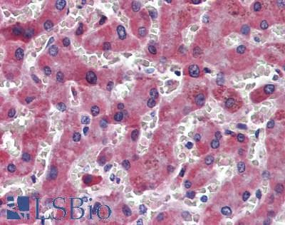 IHC-plus™ Polyclonal Rabbit anti-Human MASP1 / MASP Antibody (IHC, WB)