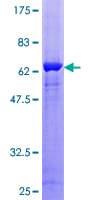Human GNB1L / FKSG1 Protein (Recombinant GST)
