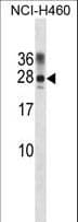 IPP2 / PPP1R2 Antibody (aa49-77)