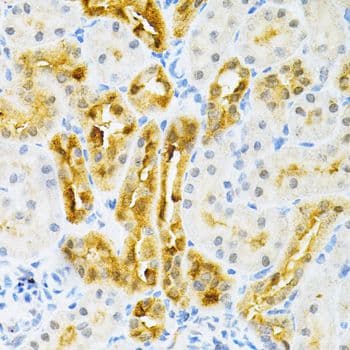 Polyclonal Rabbit anti-Human SULT2A1 / Sulfotransferase 2A1 Antibody (IHC, WB)