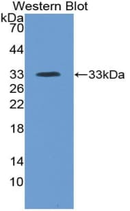 ITIH4 Antibody (aa683-928, FITC)