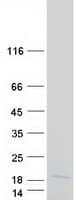 Human MRPL34 Protein (Recombinant Myc-DDK (Flag))