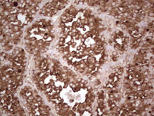 Monoclonal Mouse anti-Human TG / Thyroglobulin Antibody (clone OTI8B5, aa20-358, IHC)