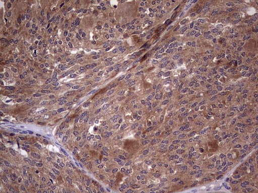 BFSP2 Antibody (aa184-415, clone OTI4E7, Carrier-free)