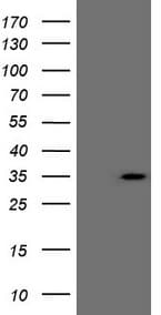 Monoclonal Mouse anti-Human CSA / ERCC8 Antibody (clone OTI1G2, IHC, WB)
