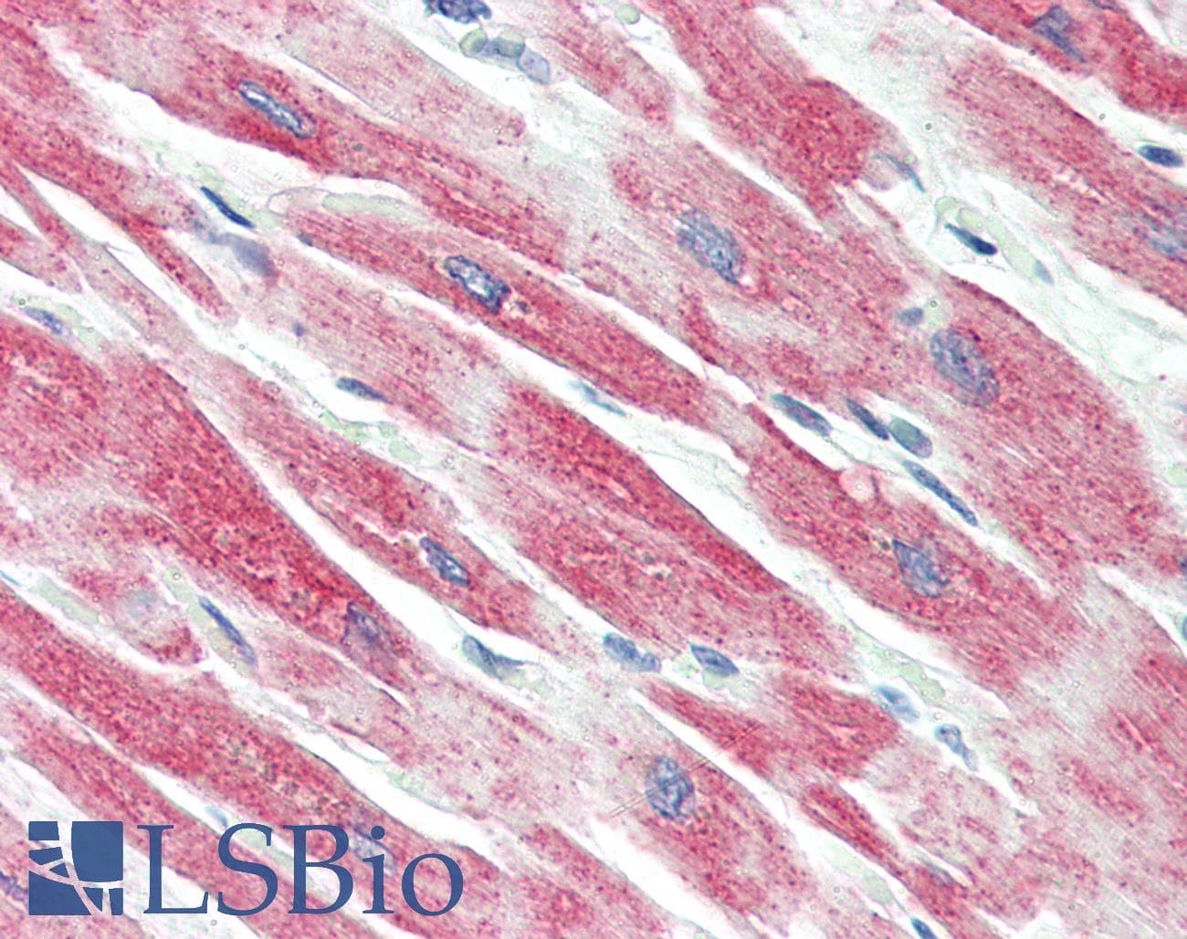 Polyclonal Rabbit anti-Human BECN1 / Beclin-1 Antibody (IHC, IF, WB)
