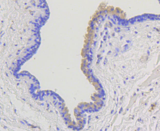 ARRB1 / Beta Arrestin 1 Antibody