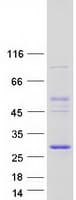 Human COMMD4 Protein (Recombinant Myc-DDK (Flag))