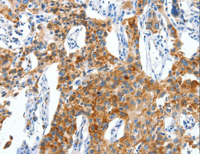 CKAP4 Antibody