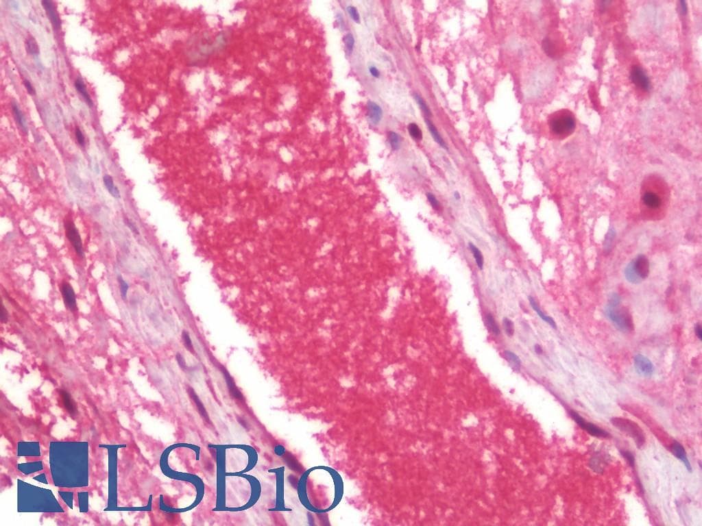 IHC-plus™ Monoclonal Mouse anti-Human FLT4 / VEGFR3 Antibody (clone 818CT12.1.1, IHC, WB)