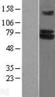 TRIM25 Protein (Over-Expression Lysate Myc-DDK (Flag))
