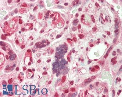 Polyclonal Rabbit anti-Human CBX3 / HP1 Gamma Antibody (aa61-110, IHC, WB)