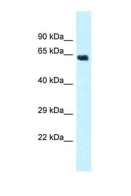 Polyclonal Rabbit anti-Human CYP4Z1 Antibody (aa252-301, WB)