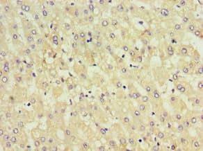 Polyclonal Rabbit anti-Human KIF6 Antibody (aa565-814, IHC)