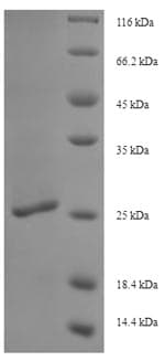 Salmonella typhi lptD Protein (Recombinant 6His-SUMO, N-terminus)