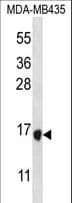 Polyclonal Rabbit anti-Human TAC4 Antibody (aa85-113, WB)