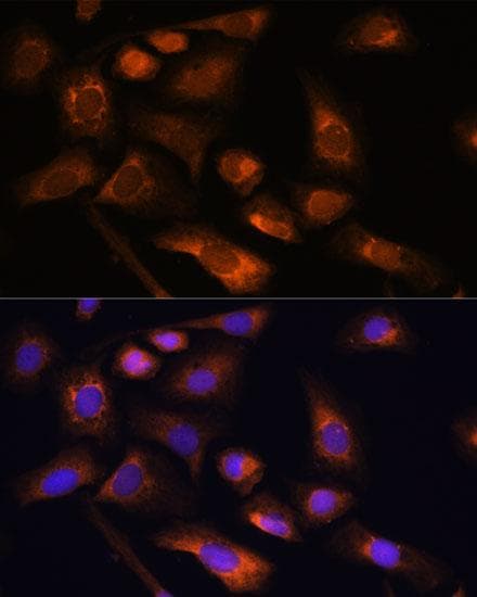 RPS13 / Ribosomal Protein S13 Antibody