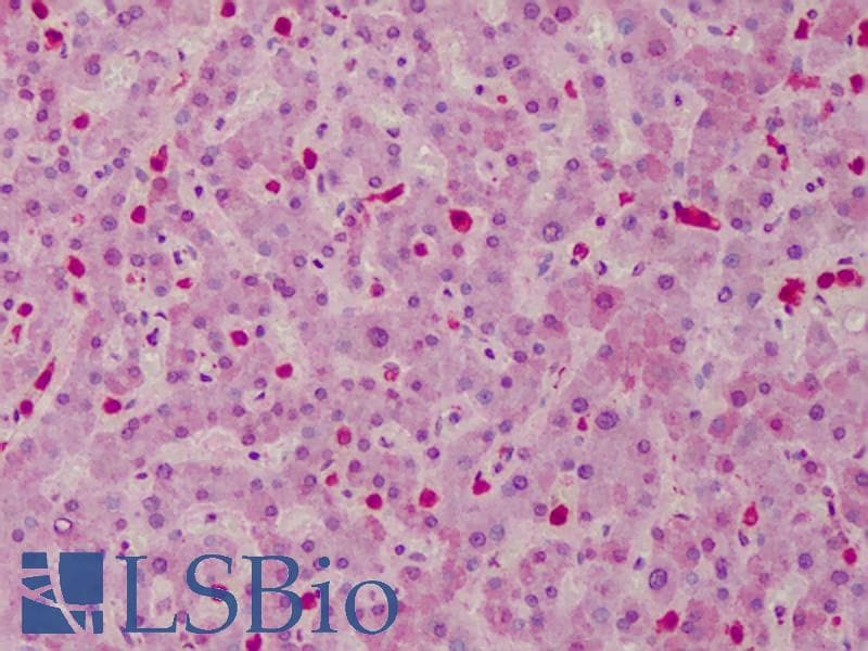 IHC-plus™ CARMA1 / CARD11 Antibody