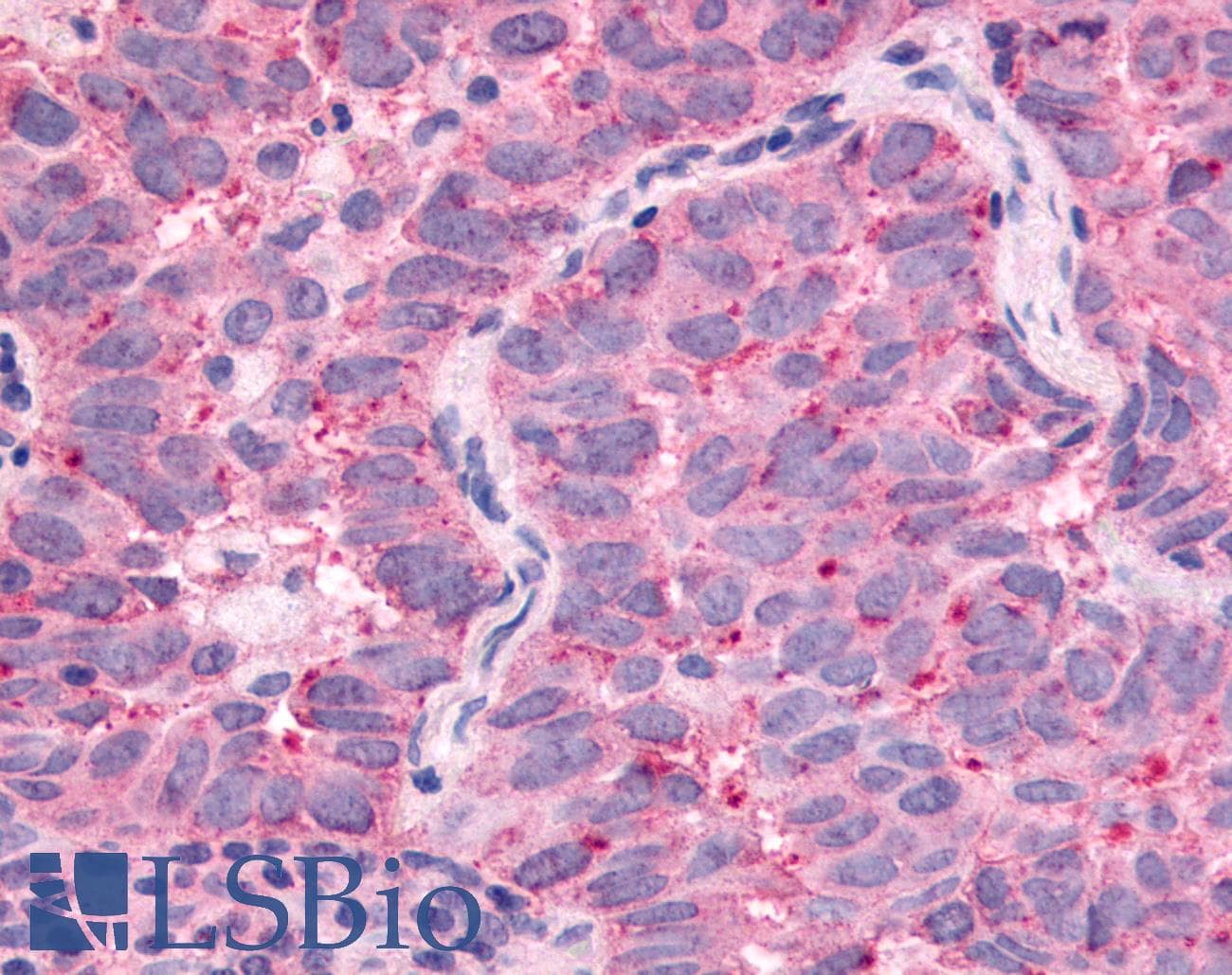 PathPlus™ WNK1 Antibody (C-Terminus)