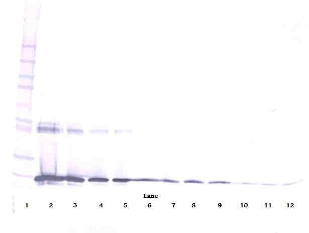 IL6 / Interleukin 6 Antibody