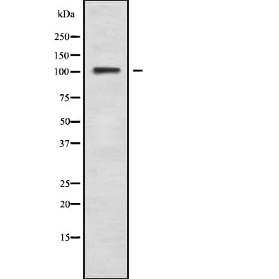 Polyclonal Rabbit anti-Human ARHGAP6 Antibody (WB)