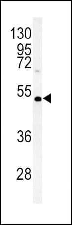 DGAT2 Antibody (aa1-30)