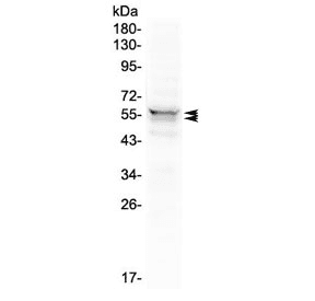 LYN Antibody