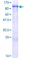 Human SSX2IP Protein (Recombinant GST)