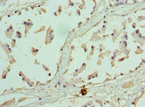 EZH1 / ENX-2 Antibody (aa160-280)
