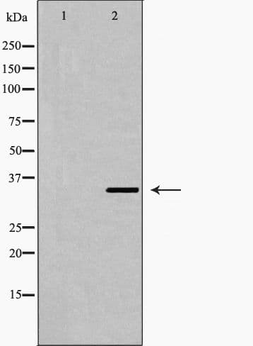 FOSL2 / FRA-2 Antibody