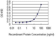 Monoclonal Mouse anti-Human HIF2A / EPAS1 Antibody (clone 1G2, IF, WB)