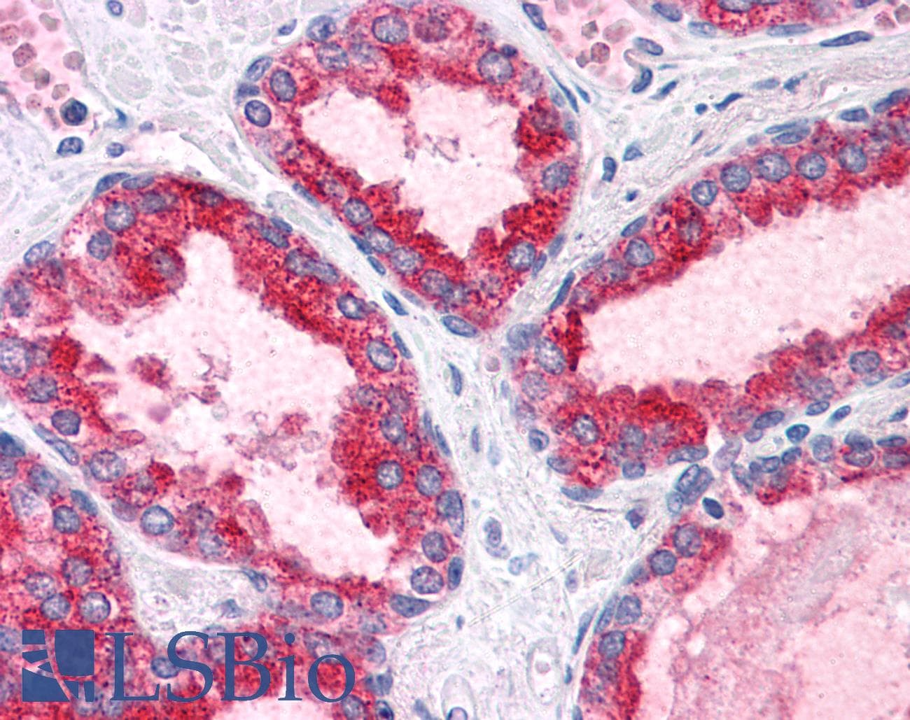 IHC-plus™ BCAS1 / NABC1 Antibody