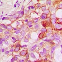 Polyclonal Rabbit anti-Human CRKL Antibody (IHC, IF, WB)