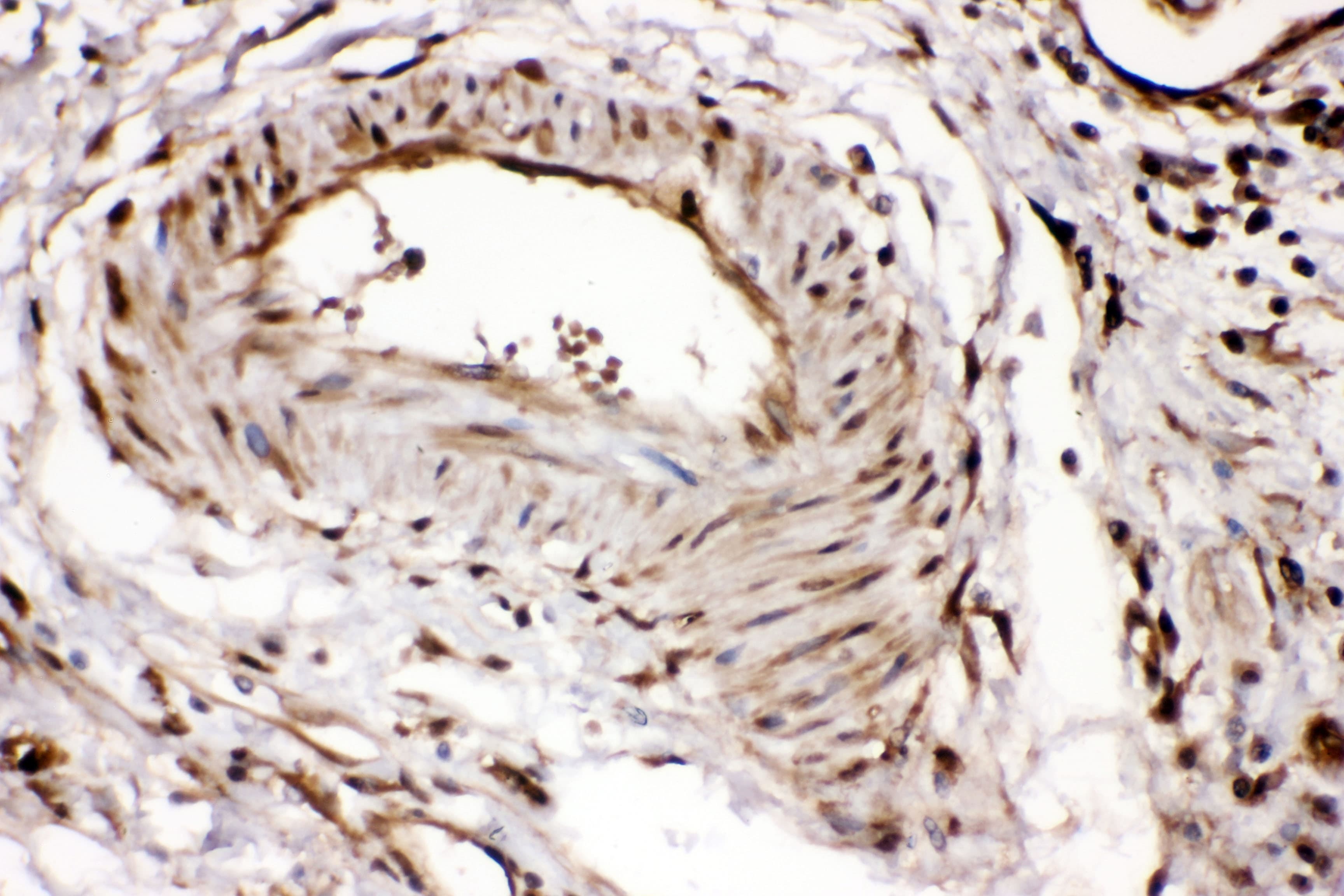 RNH1 Antibody (aa2-37)