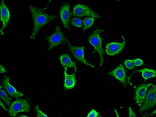 Polyclonal Rabbit anti-Human CABP2 Antibody (IF)
