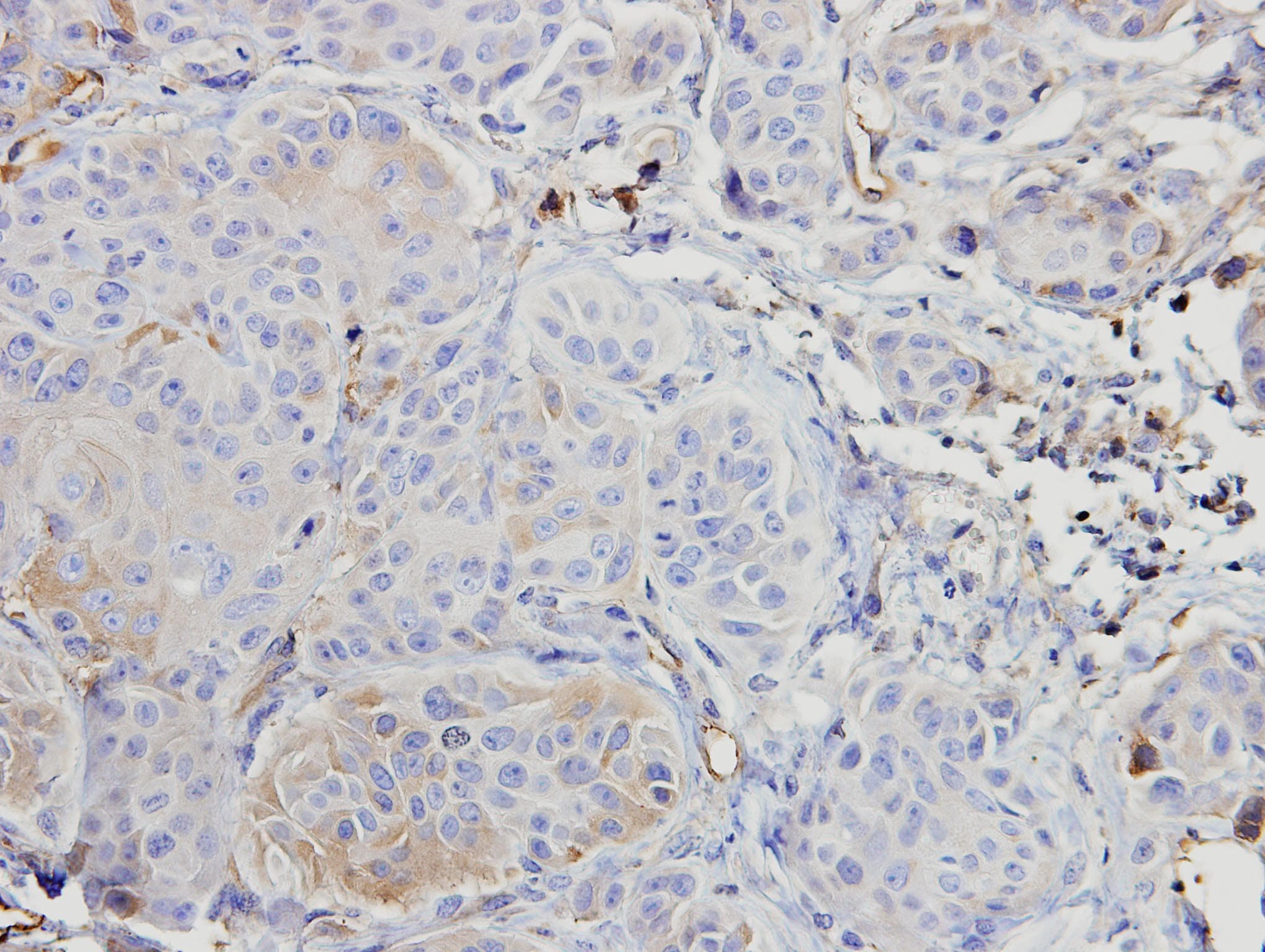 Polyclonal Rabbit anti-Human ARAF / ARAF1 / A-RAF Antibody (aa371-554, IHC, WB)