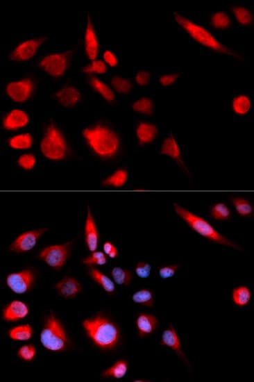 KIF2C / MCAK Antibody