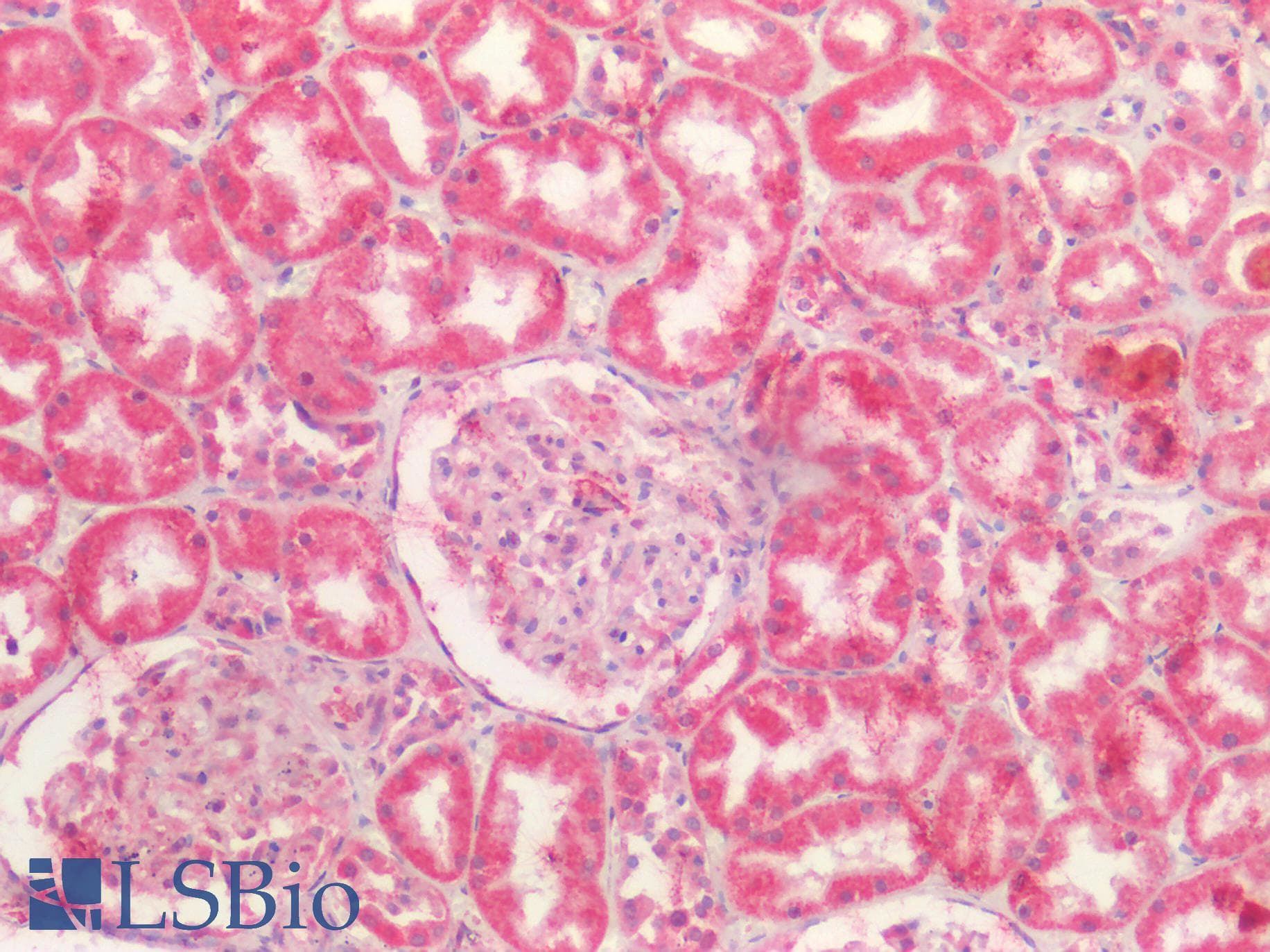 PathPlus™ BCL10 / BCL-10 Antibody (aa111-160)