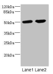 Polyclonal Rabbit anti-Human CHRNA10 Antibody (IHC, WB)