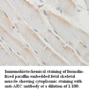 ARC / Arg3.1 Antibody