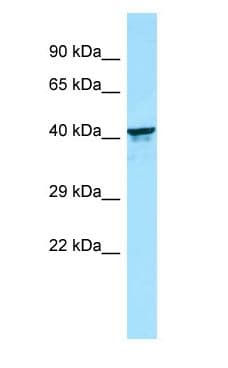 KIR2DL5B Antibody (aa290-339)