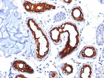 KRT18 / CK18 / Cytokeratin 18 Antibody (clone KRT18/834)