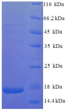 Human vpx Protein (Recombinant His)