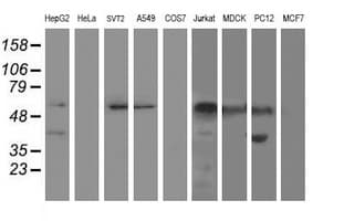 Monoclonal Mouse anti-Human AP50 / AP2M1 Antibody (clone OTI1C8, aa97-383, IF, WB)