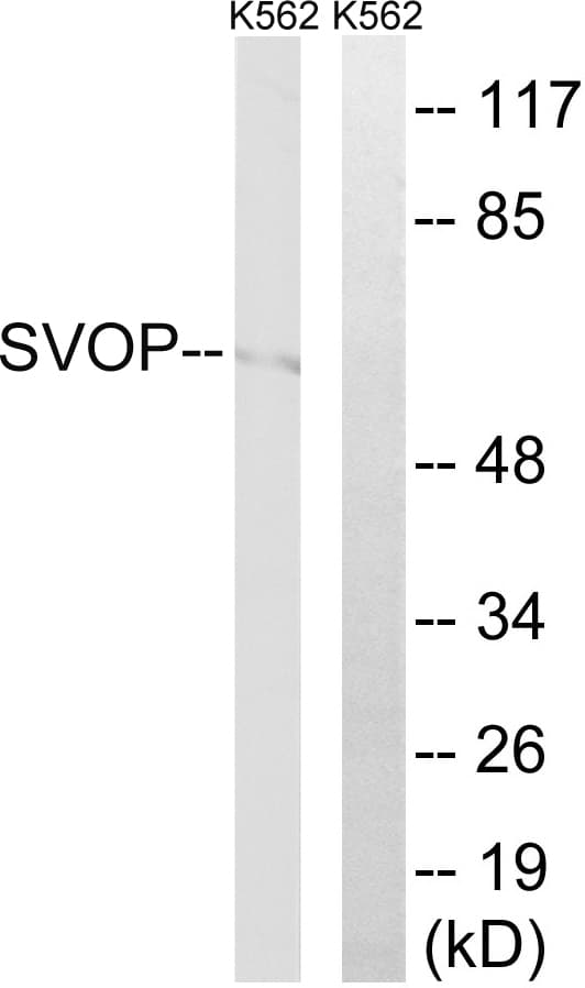 SVOP Antibody (aa271-320)