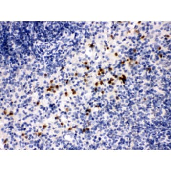 Polyclonal Rabbit anti-Mouse MMP8 Antibody (aa120-157, IHC, WB)