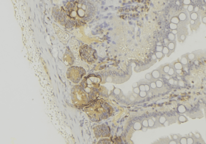 PEX6 Antibody
