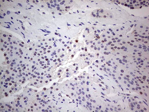 PCNA Antibody (clone OTI13G4)