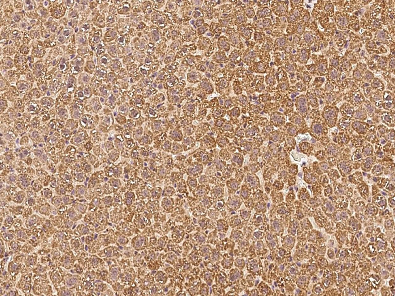 VDAC1 / PORIN Antibody (Preservative Free)