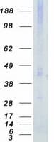Human STK17B / DRAK2 Protein (Recombinant Myc-DDK (Flag))